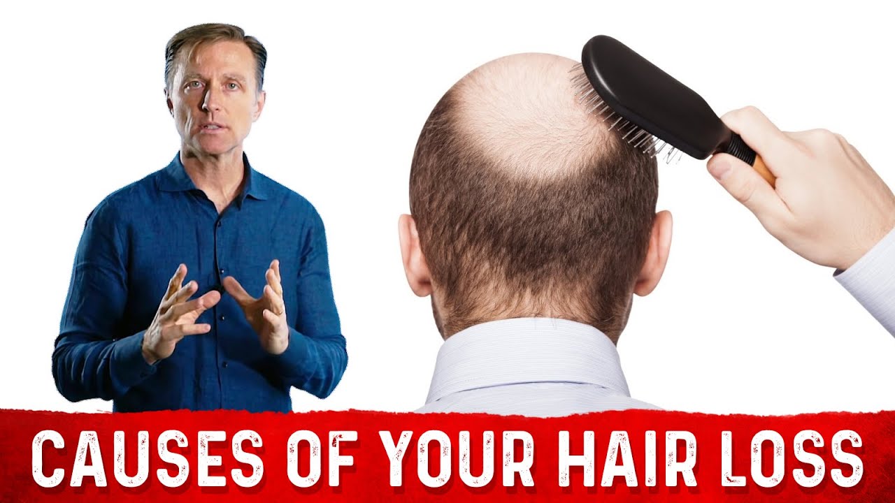The Causes of Hair Loss Dr. Berg