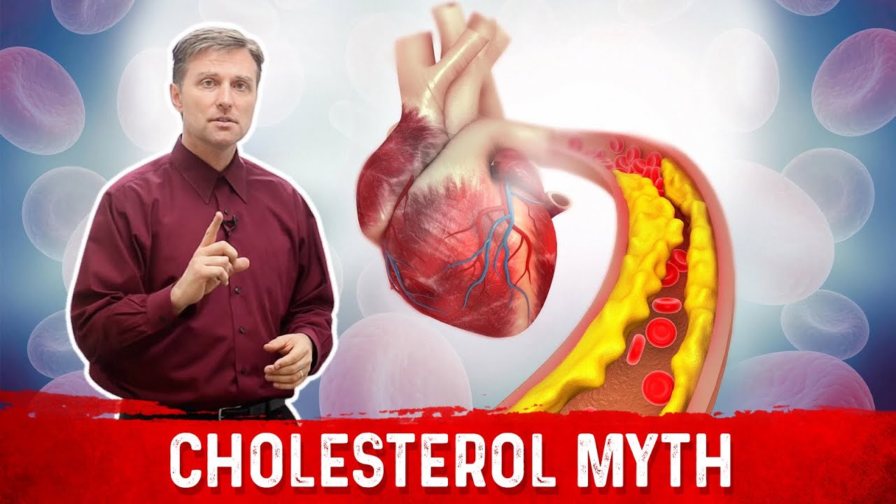 The Truth Behind The Cholesterol Myth You Should Know | Dr. Berg