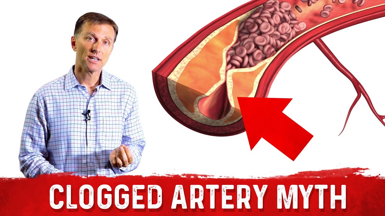 The Clogged Artery Myth Healthy Keto™ Dr. Berg