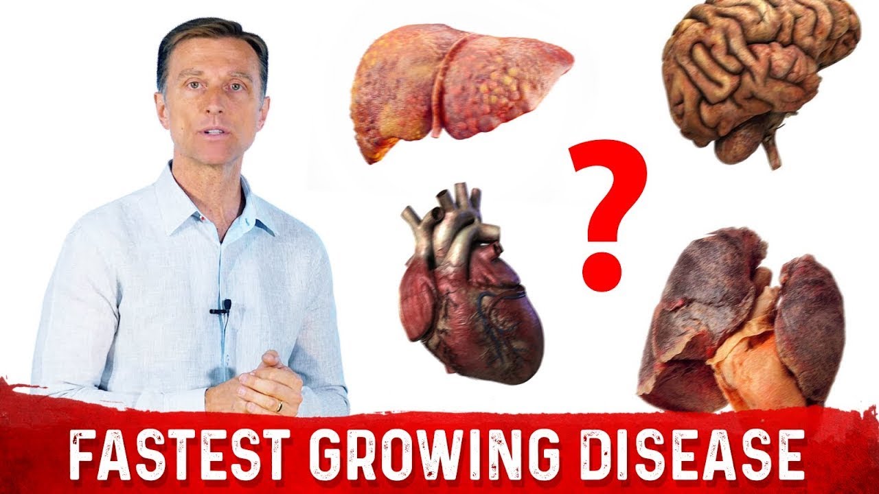 what-is-the-fastest-growing-disease-in-the-world