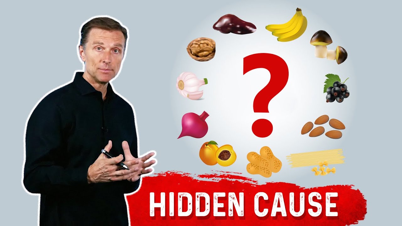 The Hidden Cause of a Manganese Deficiency Dr. Berg