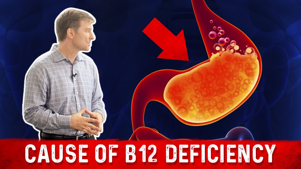 What Is The Most Common Cause Of B12 Deficiency