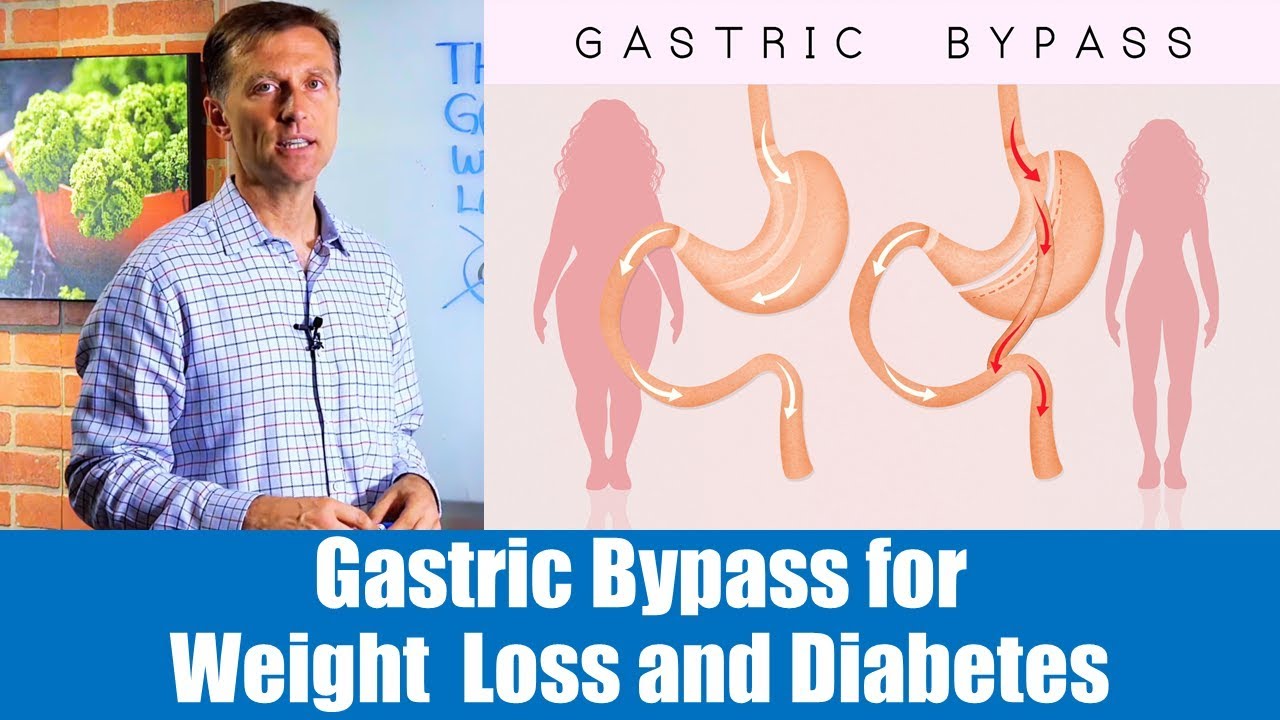 The REAL Reason Why Gastric Bypass Works