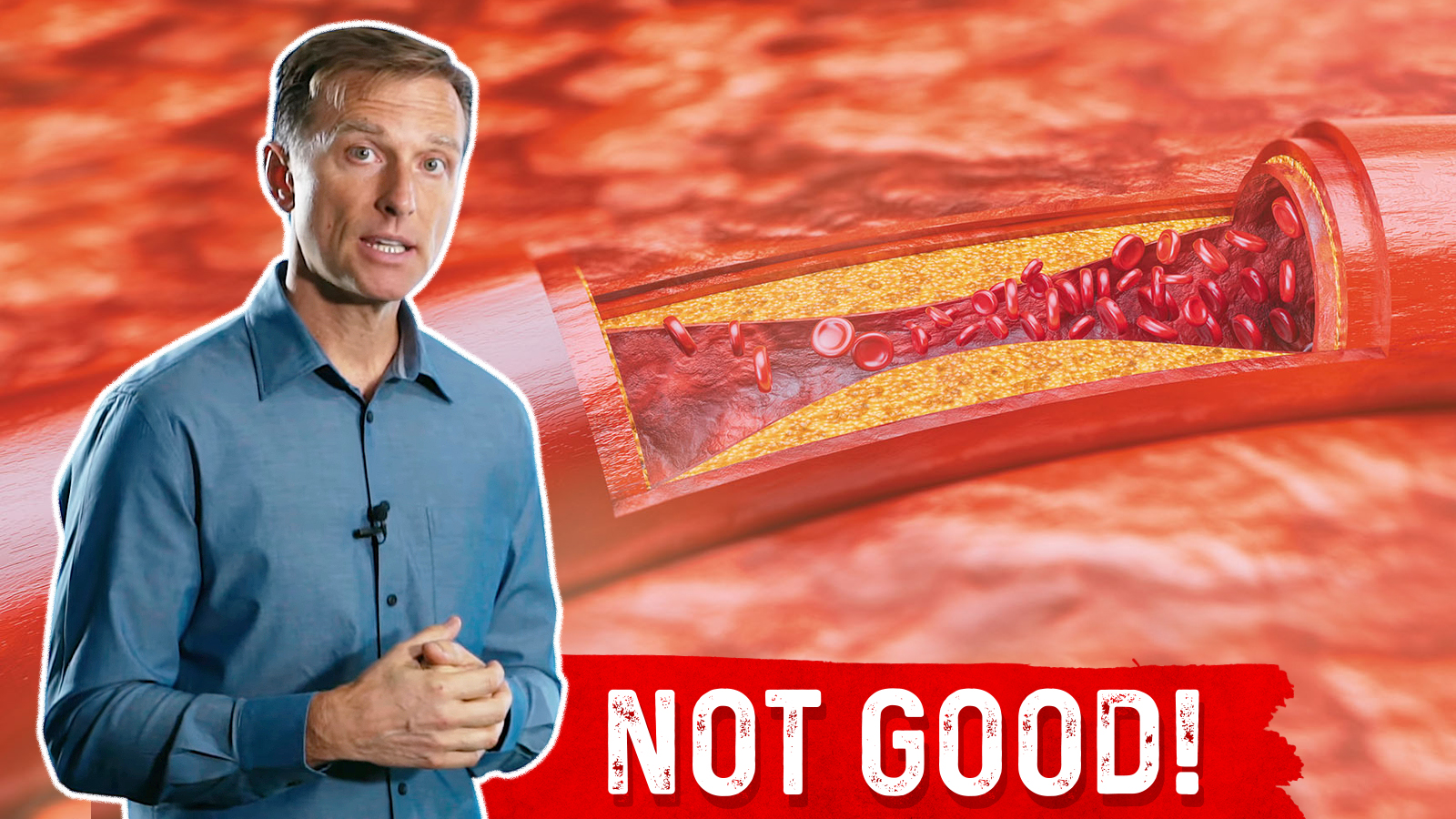 This Is What Sugar Does to Your Arteries Healthy Keto™