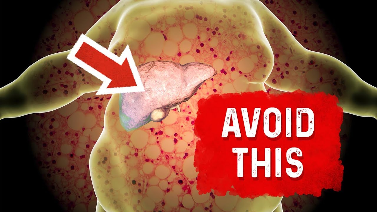 Use Bile Salts for a Fatty Liver Dr. Berg