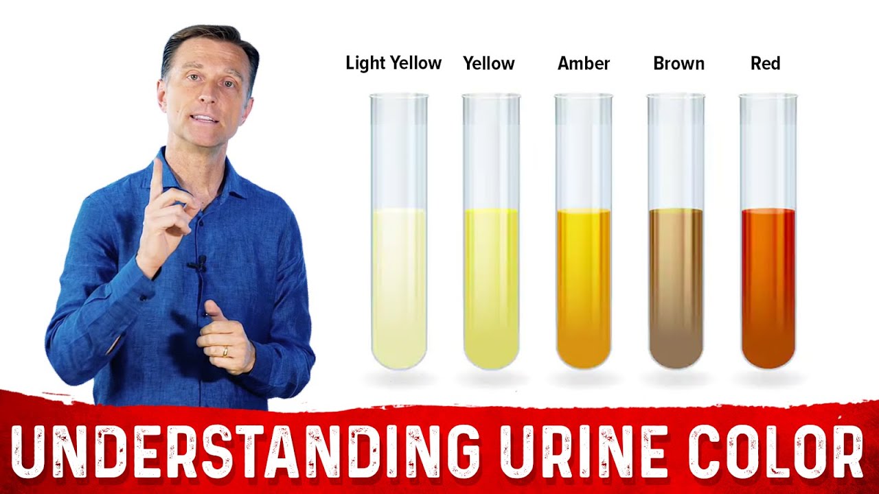 What Does the Color of Your Urine Mean Dr. Berg