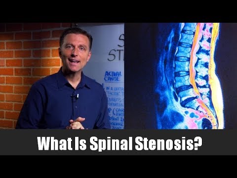 What Is Spinal Stenosis? | Healthy Keto™ Dr. Berg