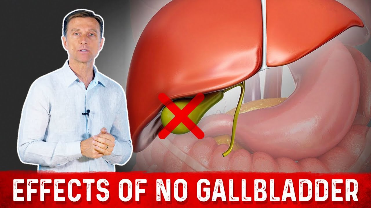 what-you-must-know-if-you-dont-have-a-gallbladder-dr-berg