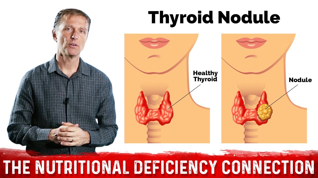 what-s-behind-thyroid-nodules