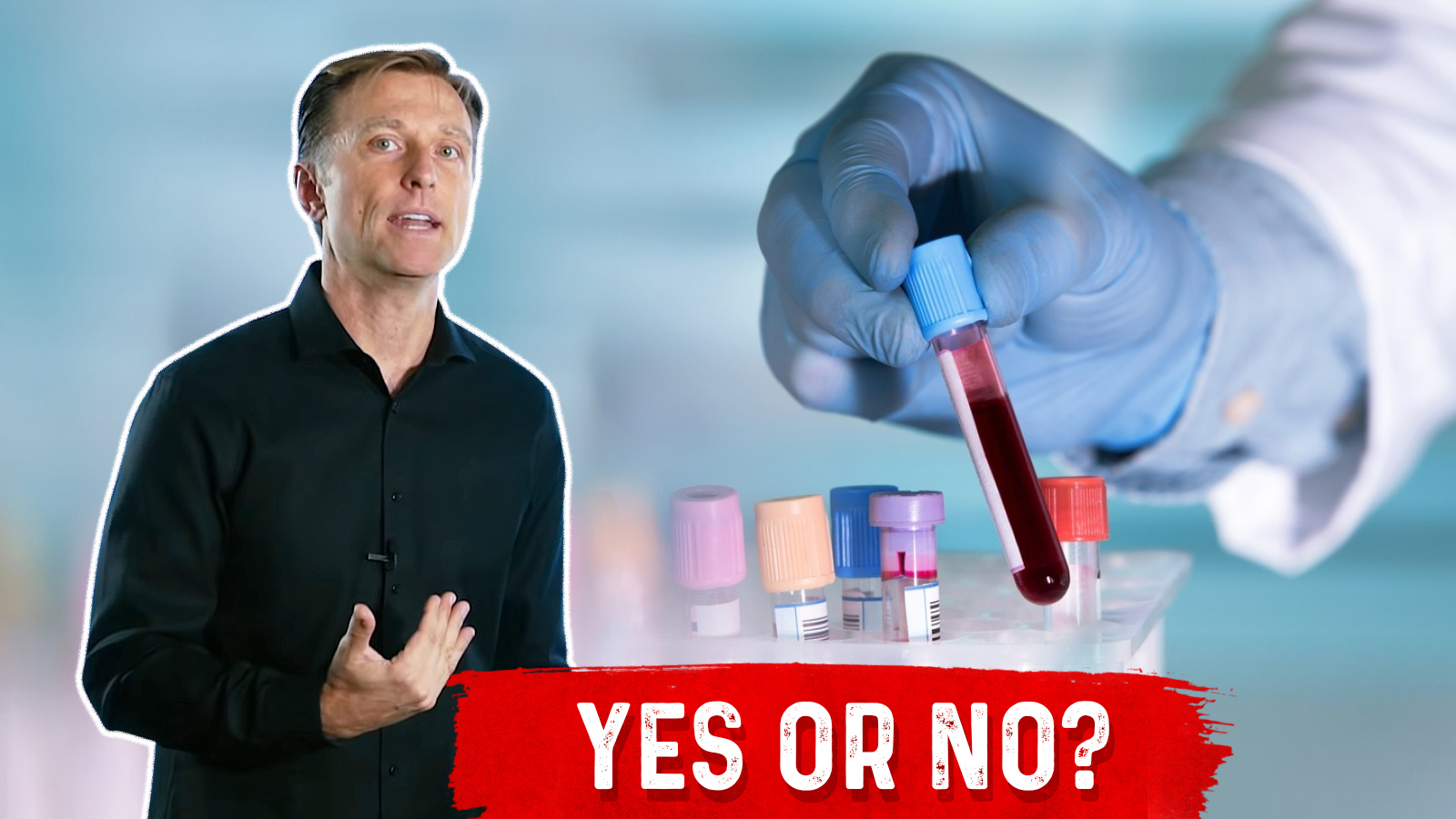 Will Your Blood Test Detect Vitamin Deficiencies Dr. Berg