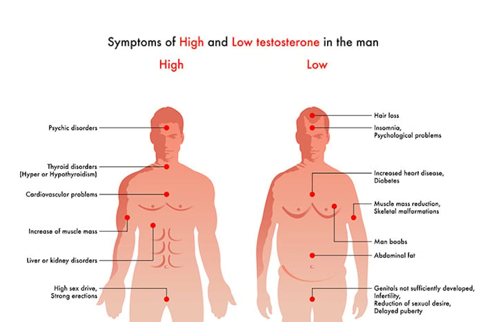 Low testosterone can contribute to hair loss