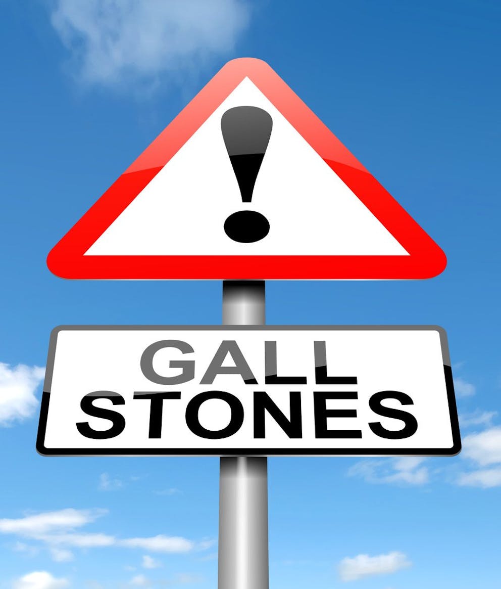 Street sign with exclamation mark, warning gallstones and gallstone prevention.