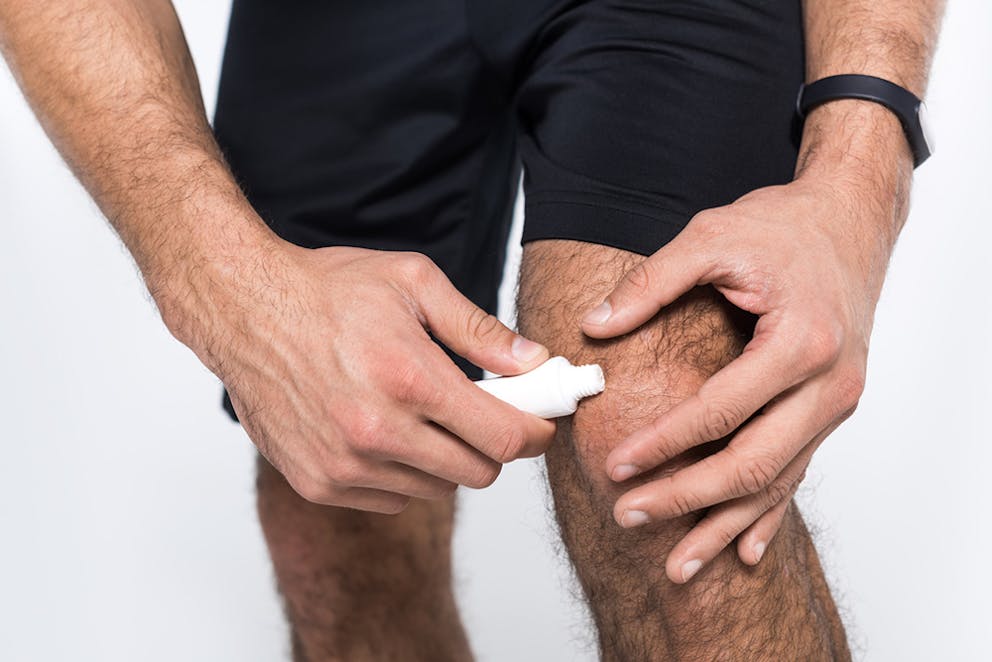 Athletic man applies topical cream from a tube to knee, joint pain remedy.