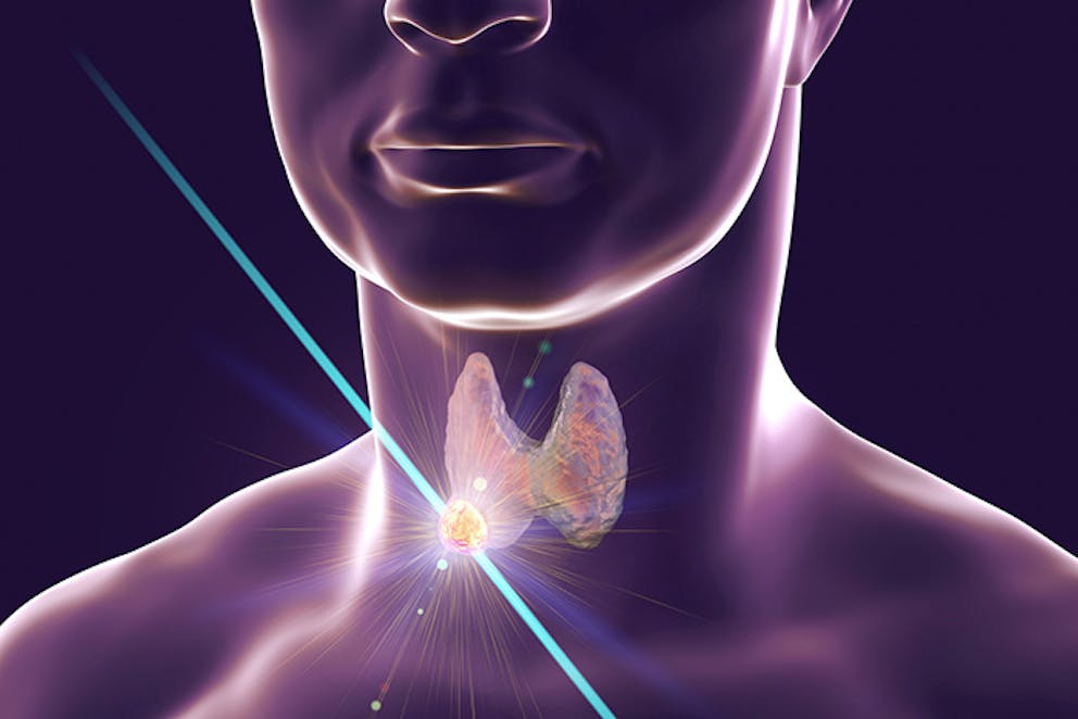 Nodules on the thyroid gland 