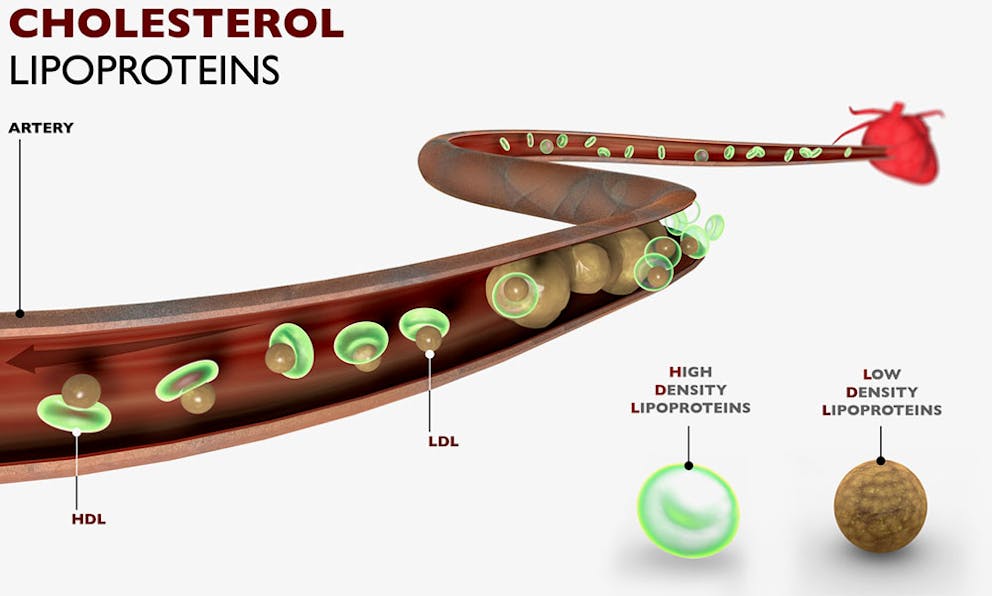 Anatomy drawing of artery with different types of cholesterol lipoproteins, HDL and LDL.