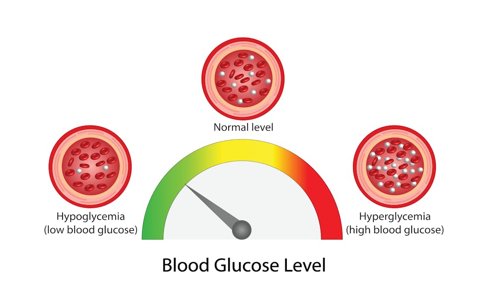 Blood glucose level illustration