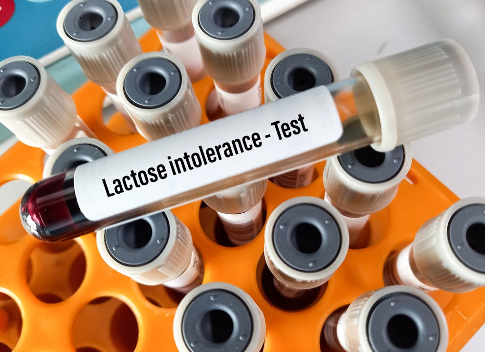 Lactose intolerance test