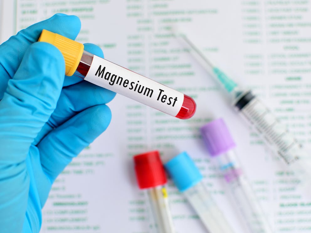Magnesium blood test