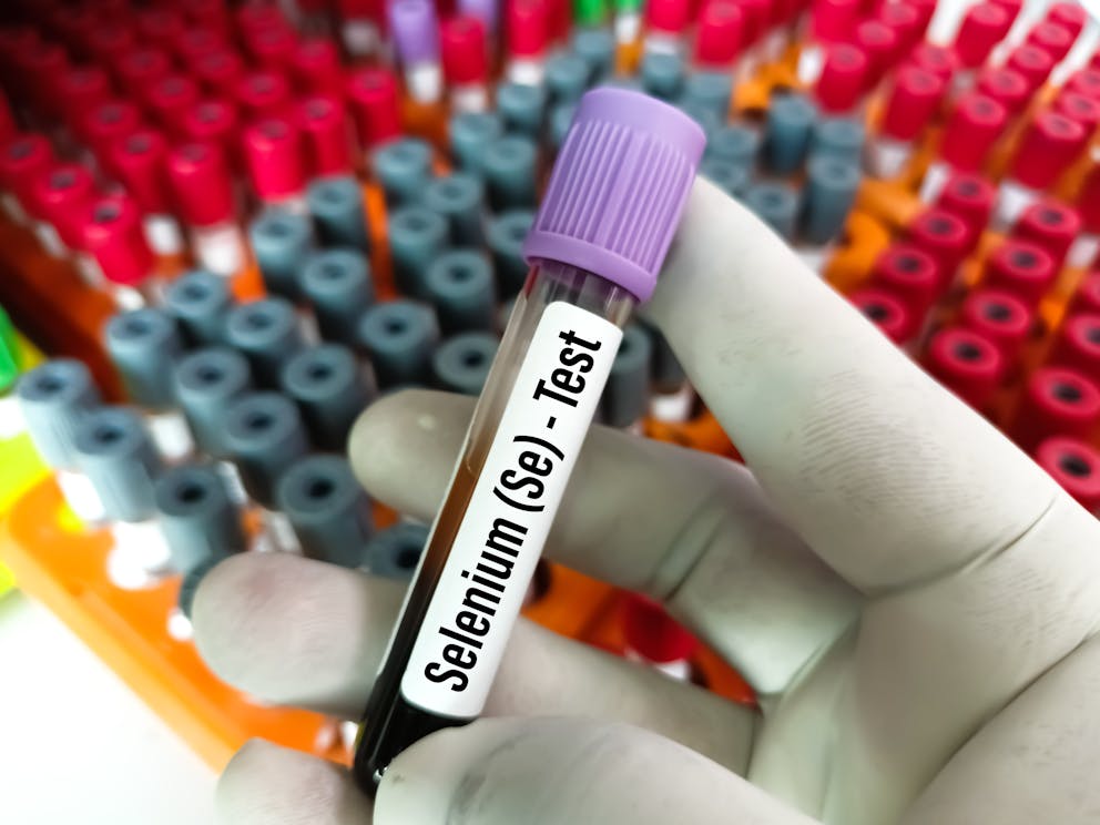 Selenium blood test