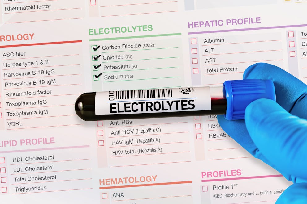 Electrolyte blood sample