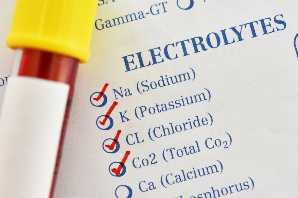 Electrolyte panel checklist