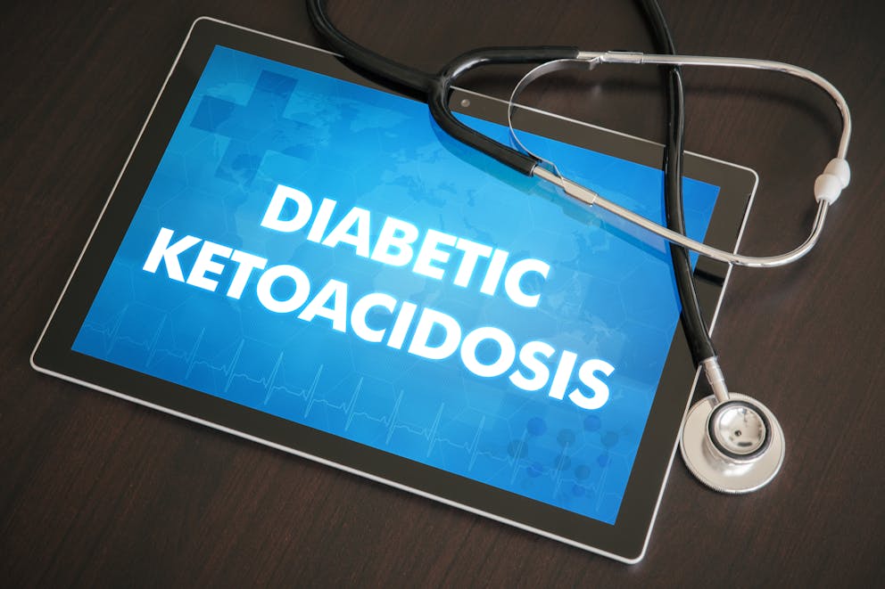 Diabetic ketoacidosis