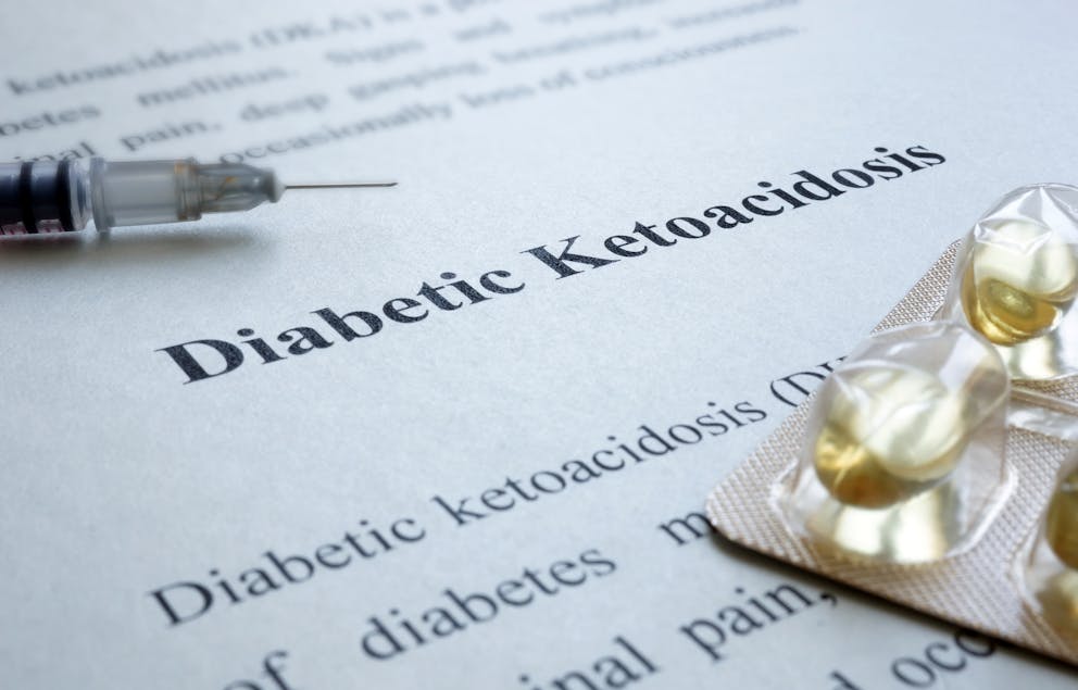 Diabetic ketoacidosis illustration