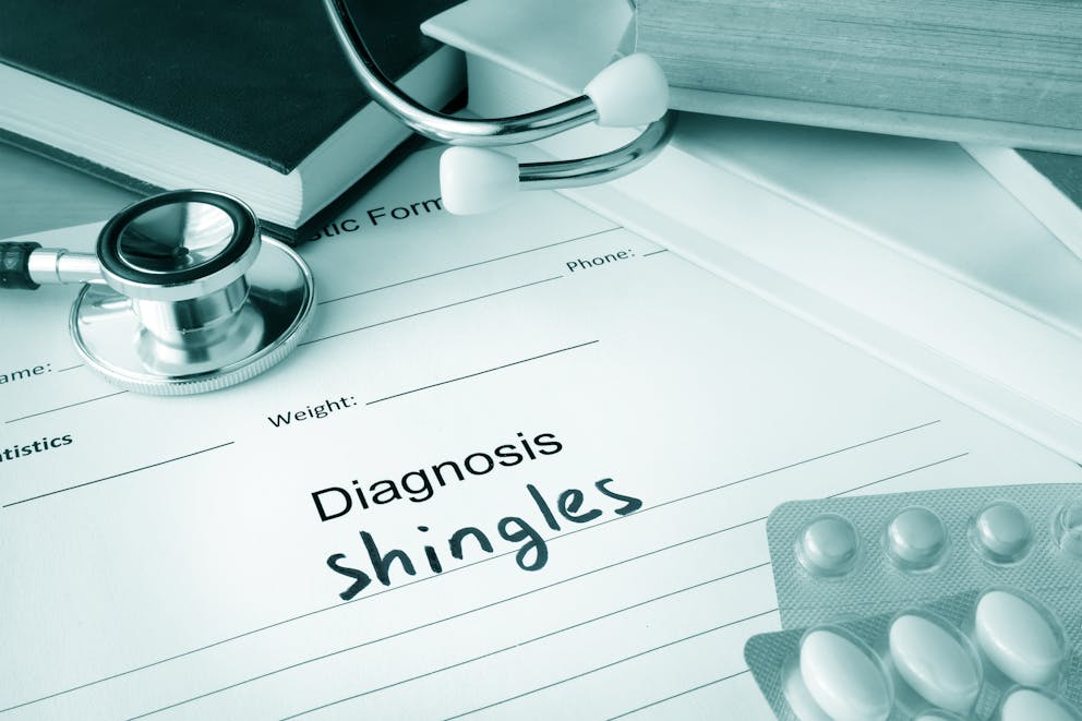 Shingles diagnosis with pills