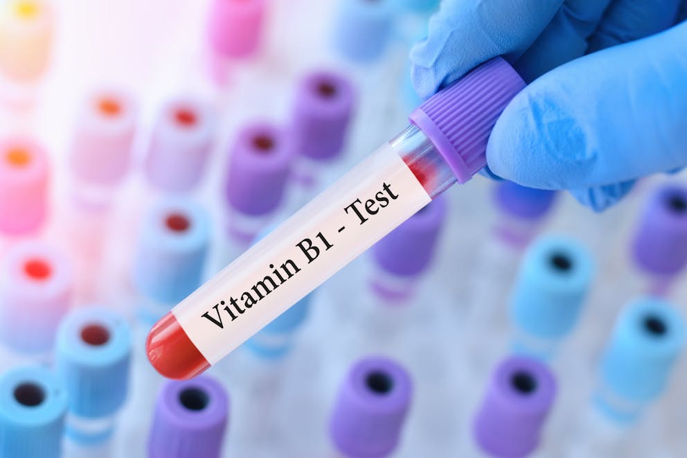 Vitamin B1 blood test