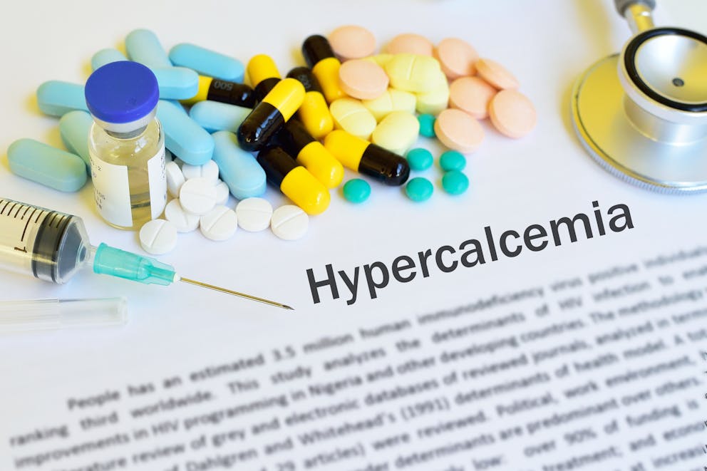 Hypercalcemia concept