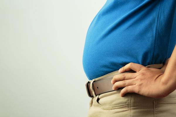 Ascites vs. Belly Fat: Know the Difference | Dr. Berg