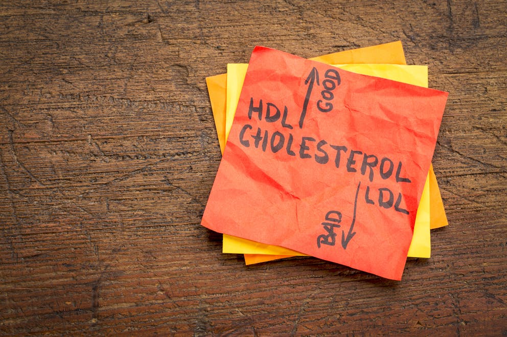 Cholesterol written on Post-it note