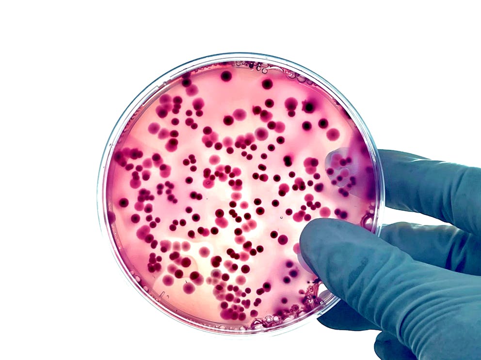 Bacteria in a petri dish