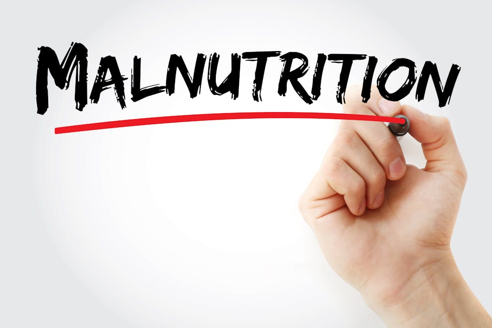 Malnutrition