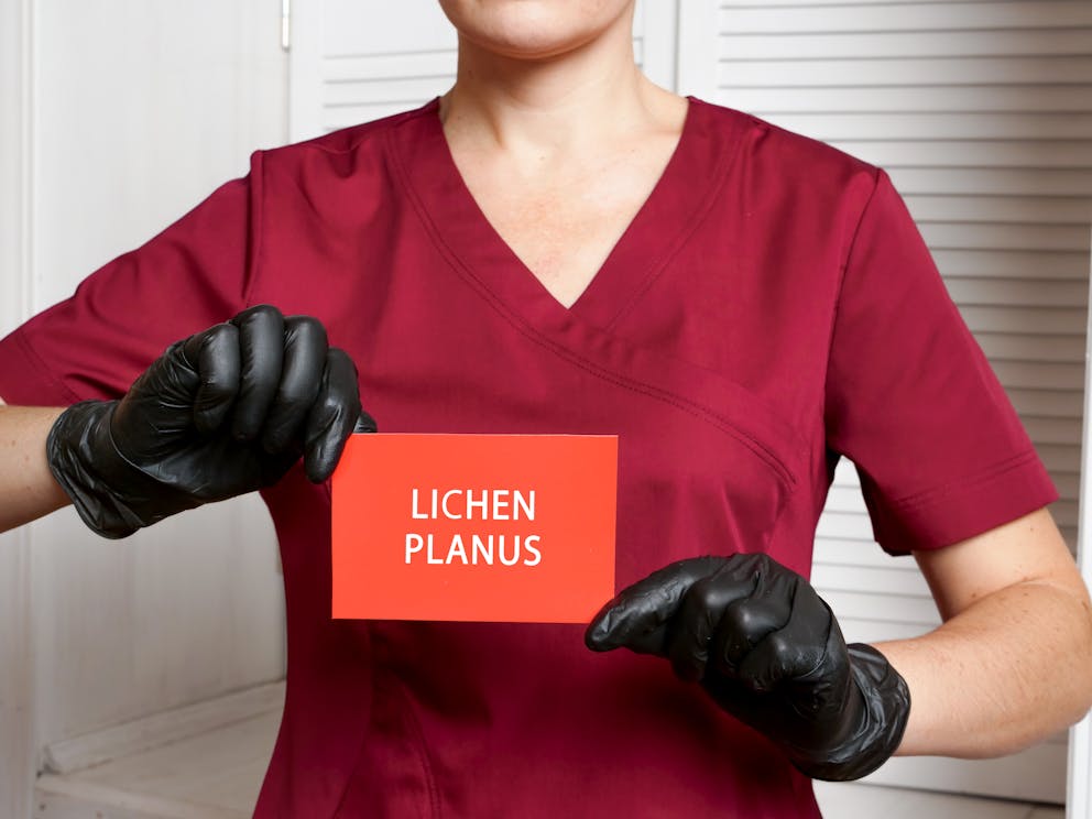 Nurse holding lichen planus sign