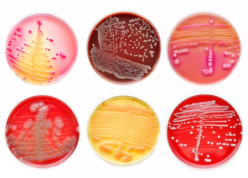 Petri dishes with bacterial cultures