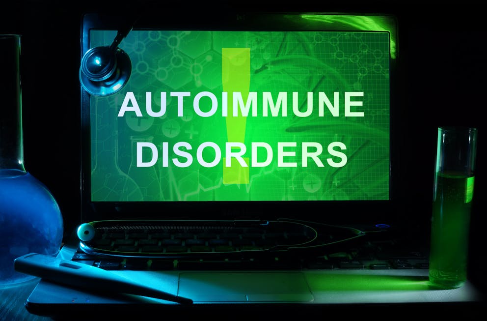 Notebook with words autoimmune disorders