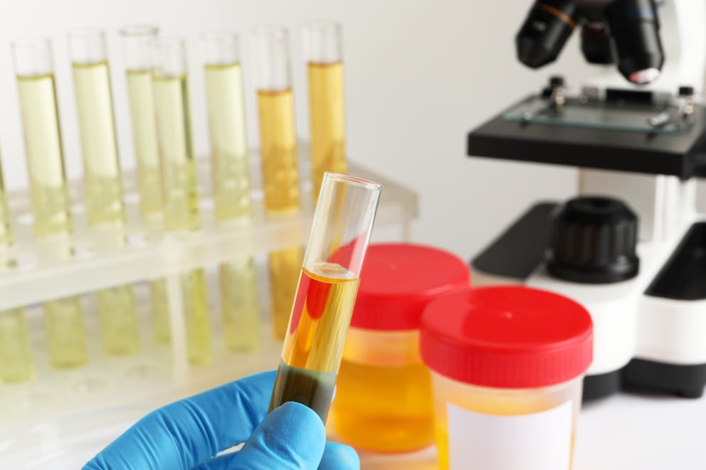 urine samples and a microscope