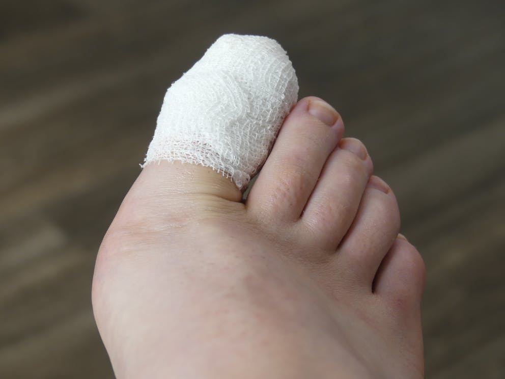 Big toe injury