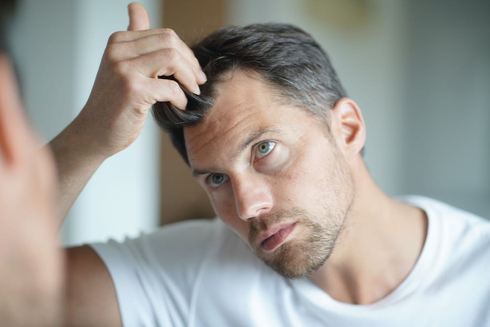 Man worrying about hair loss