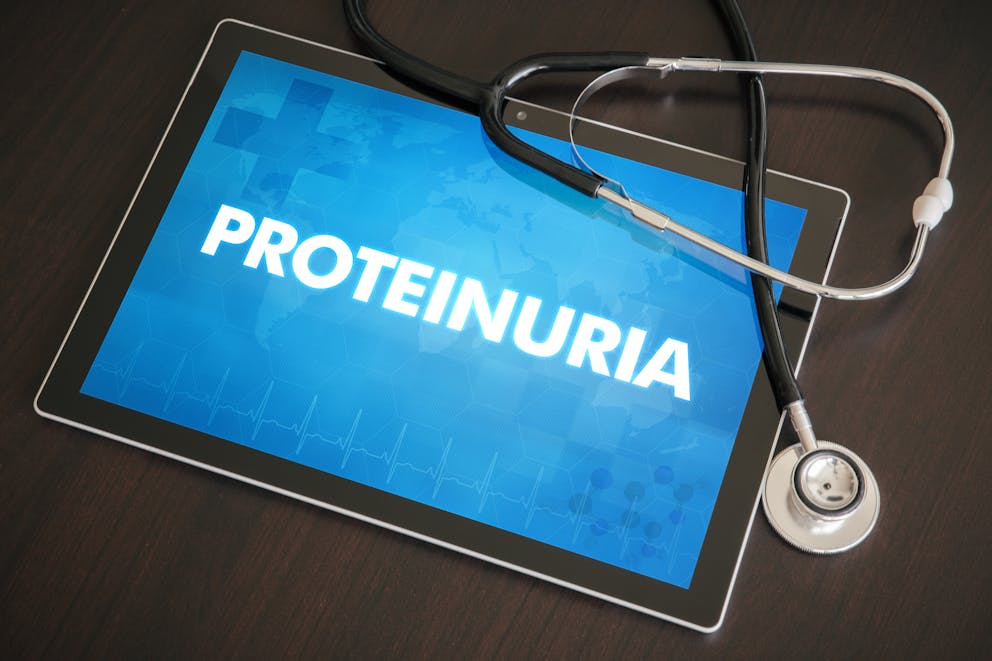 Proteinuria sign