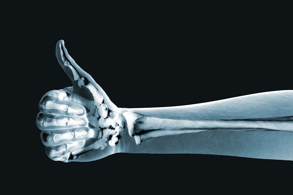 X-ray image of bone