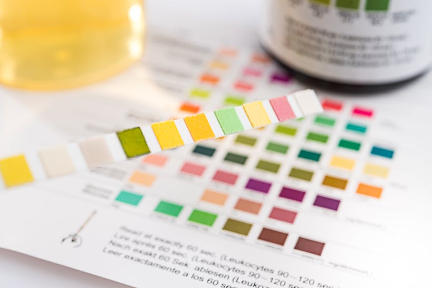 Uncover the Mystery Why Does Your Pee Smell Like Popcorn? Dr. Berg