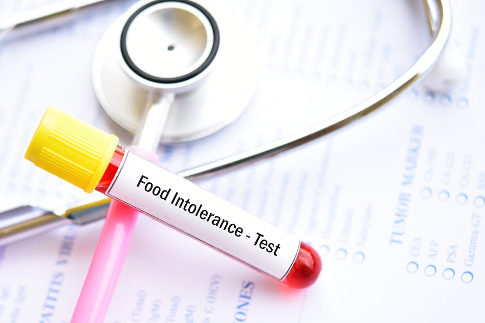 Food intolerance test