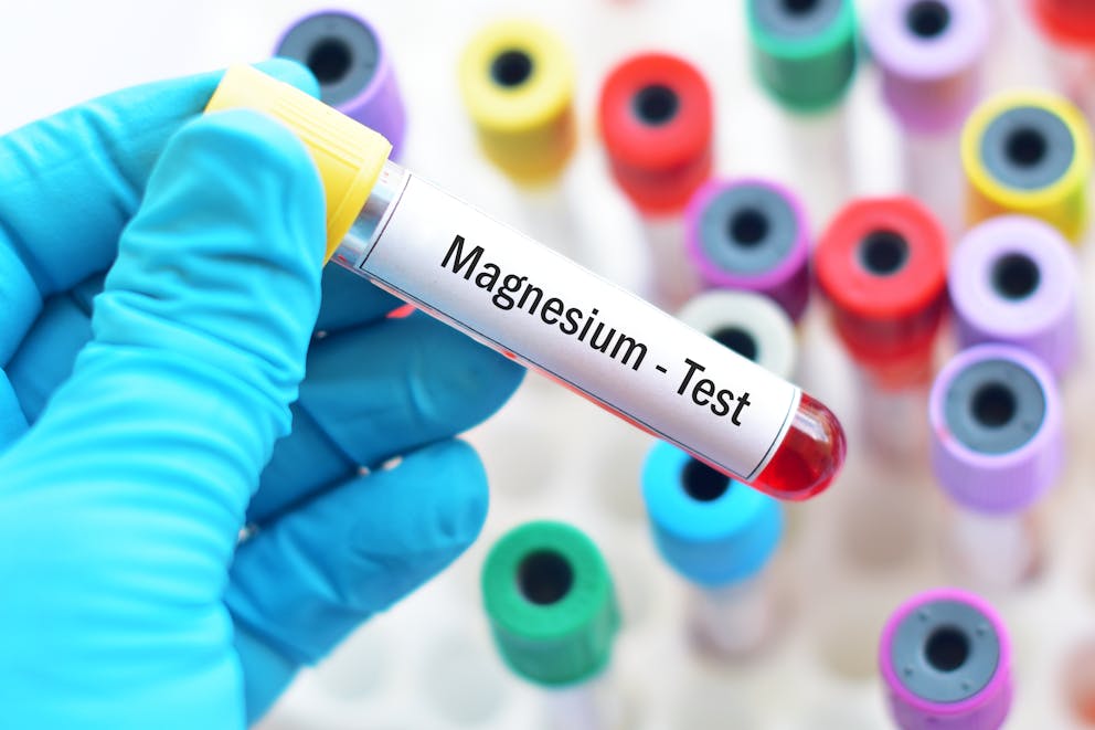 Magnesium blood test sample
