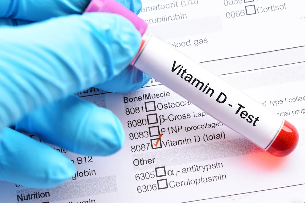 Vitamin D blood sample