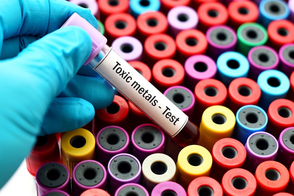 Toxic metals blood test