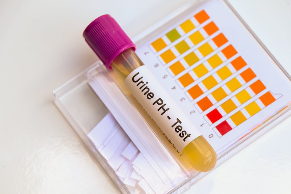 Urine pH test