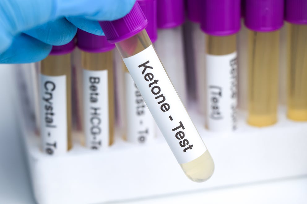 Ketone blood test vial