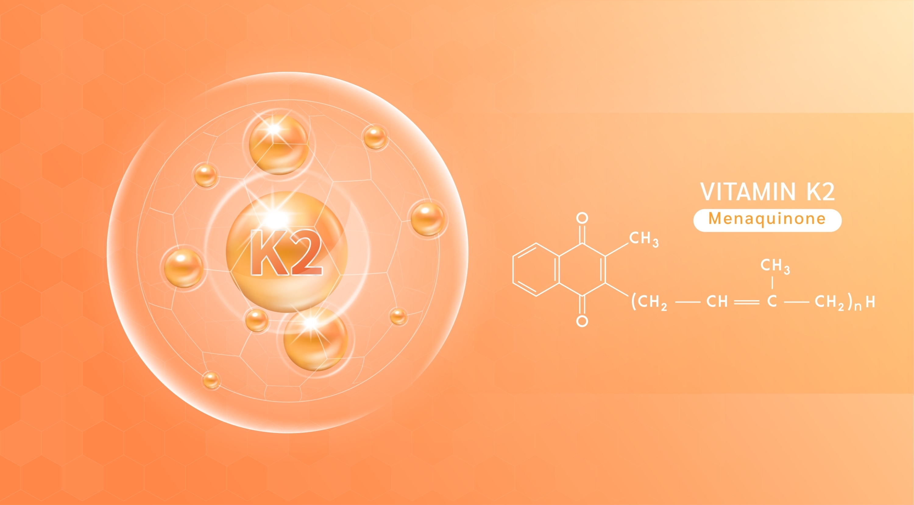 Can Vitamin K2 Dissolve Kidney Stones? Dr. Berg